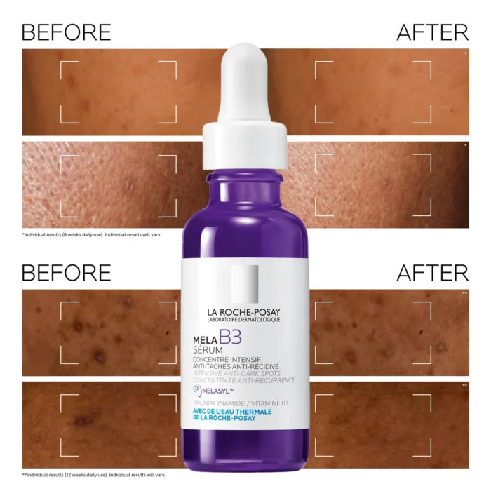La Roche Posay Mela B3 Serum – 30ml