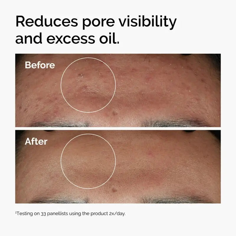 The Ordinary Niacinamide 10% + Zinc 1% – 30ml