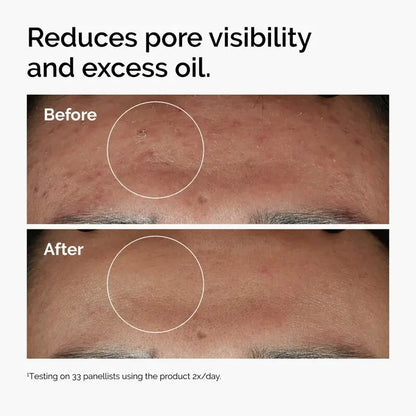 The Ordinary Niacinamide 10% + Zinc 1% – 30ml